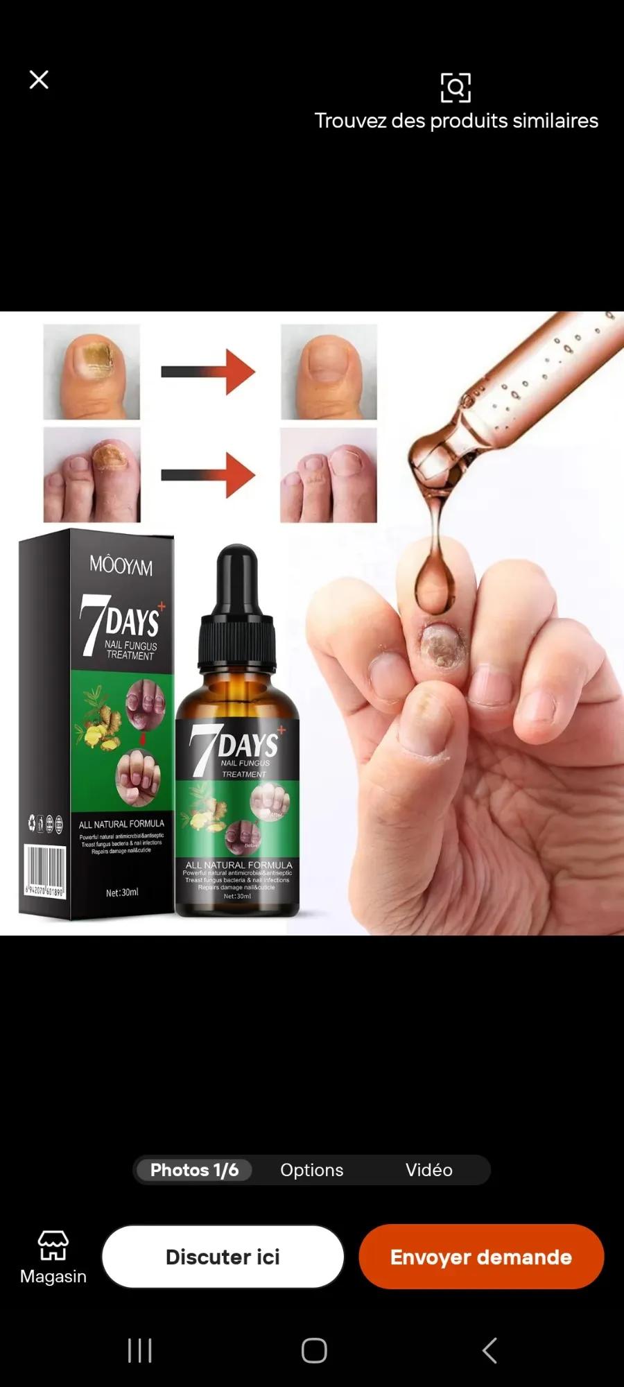 Remaide contre mauvais bousse ongle